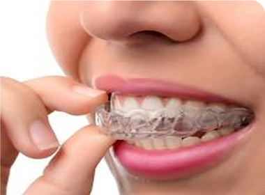 Knirscherschiene (Aufbissschiene)